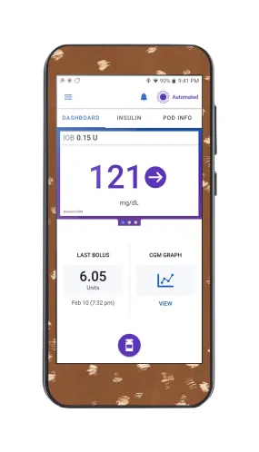 Deer Hide Omnipod 5™