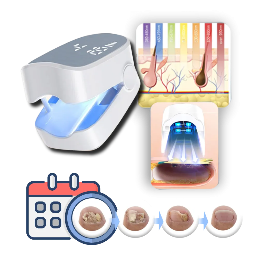 Laser Therapy, Pain-Free For Nail Fungus