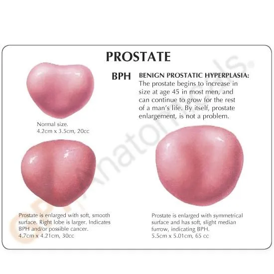 Male Pelvis with 3D Prostate Frame