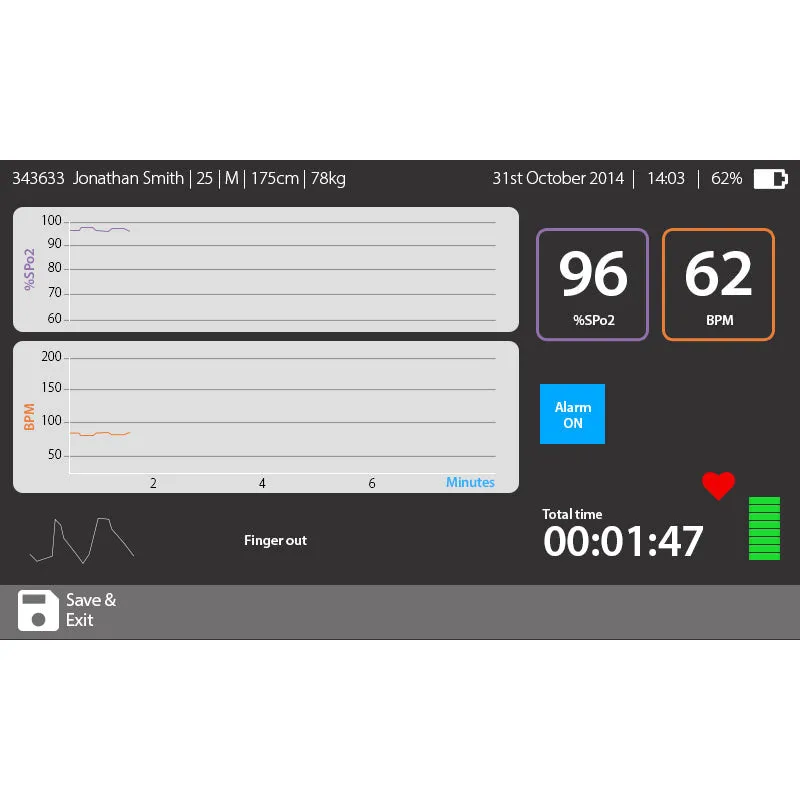 MIR Intermedical Spirolab Spirometer with Disposable Turbines