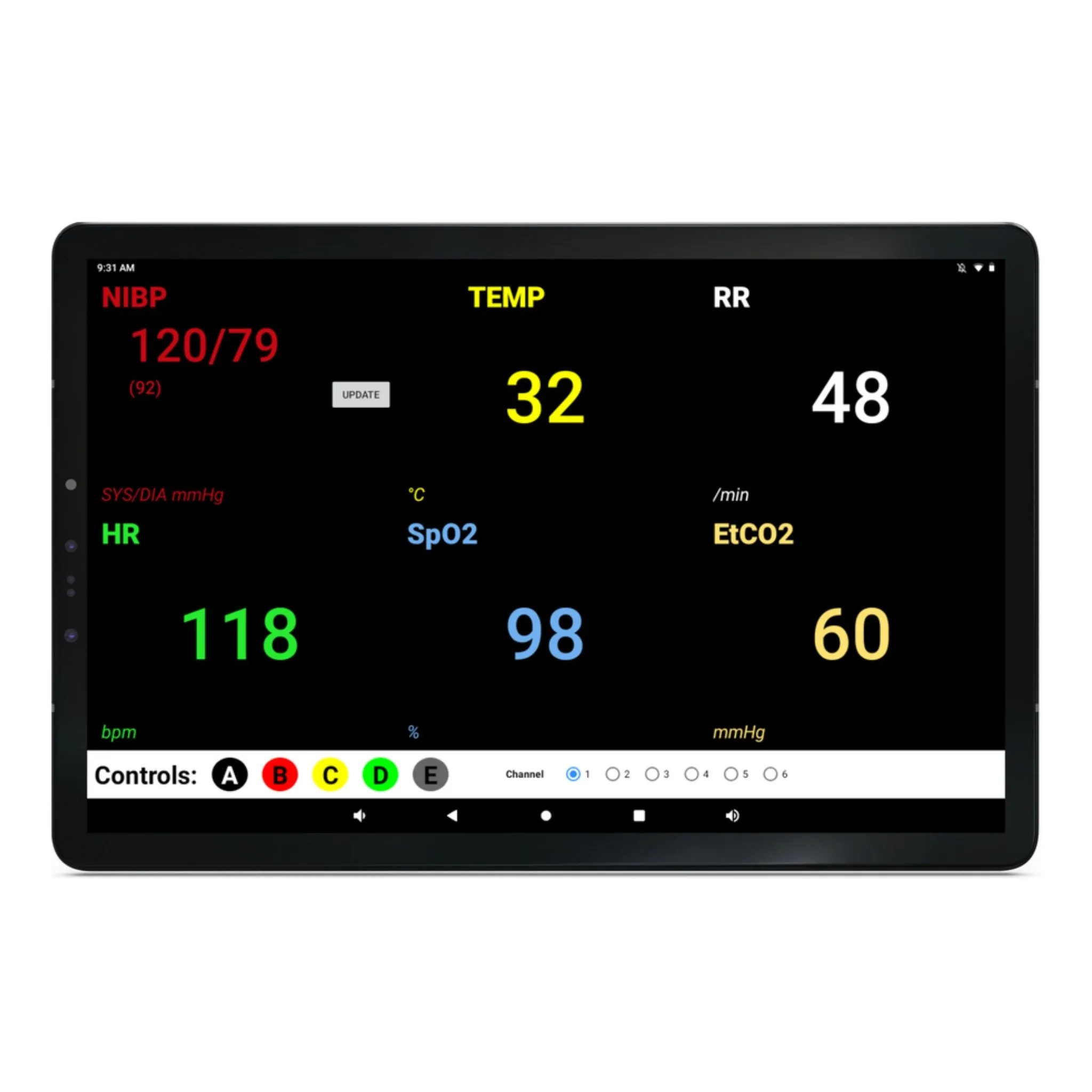 SimVS Simulated Patient Monitor Software