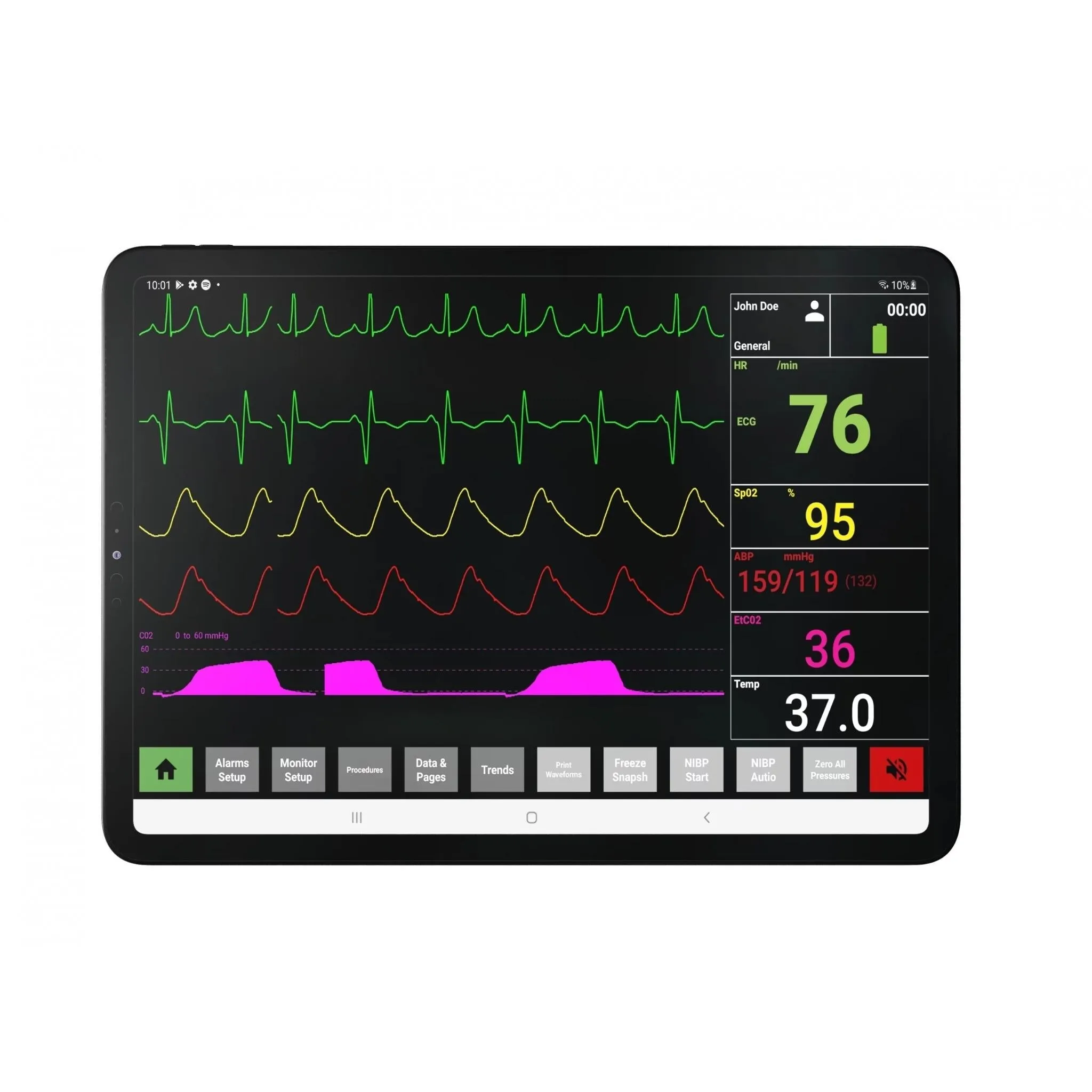 SimVS Simulated Patient Monitor Software