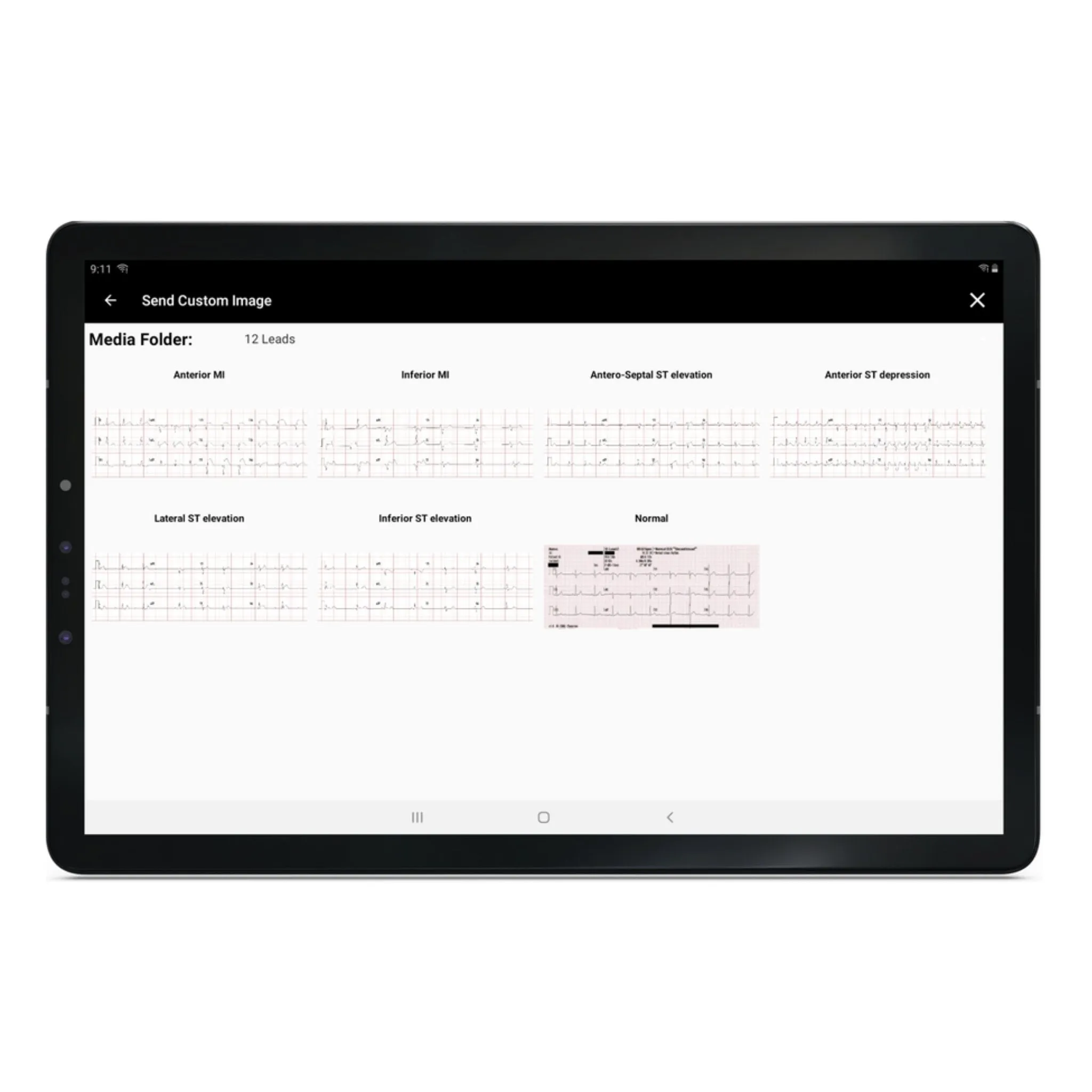 SimVS Simulated Patient Monitor Software