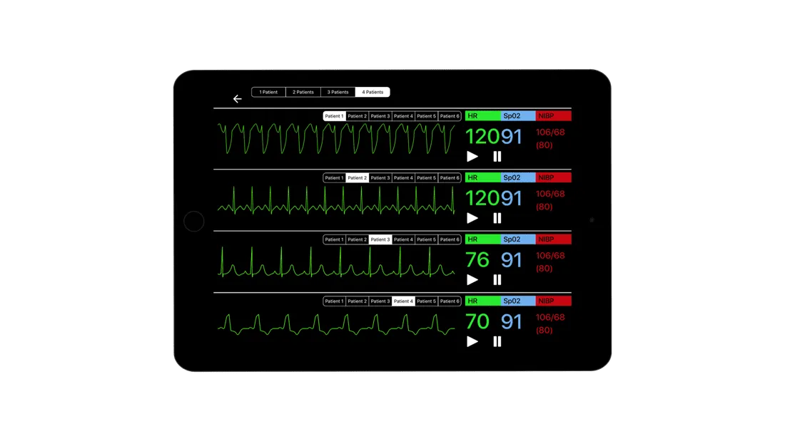 SimVS Simulated Patient Monitor Software