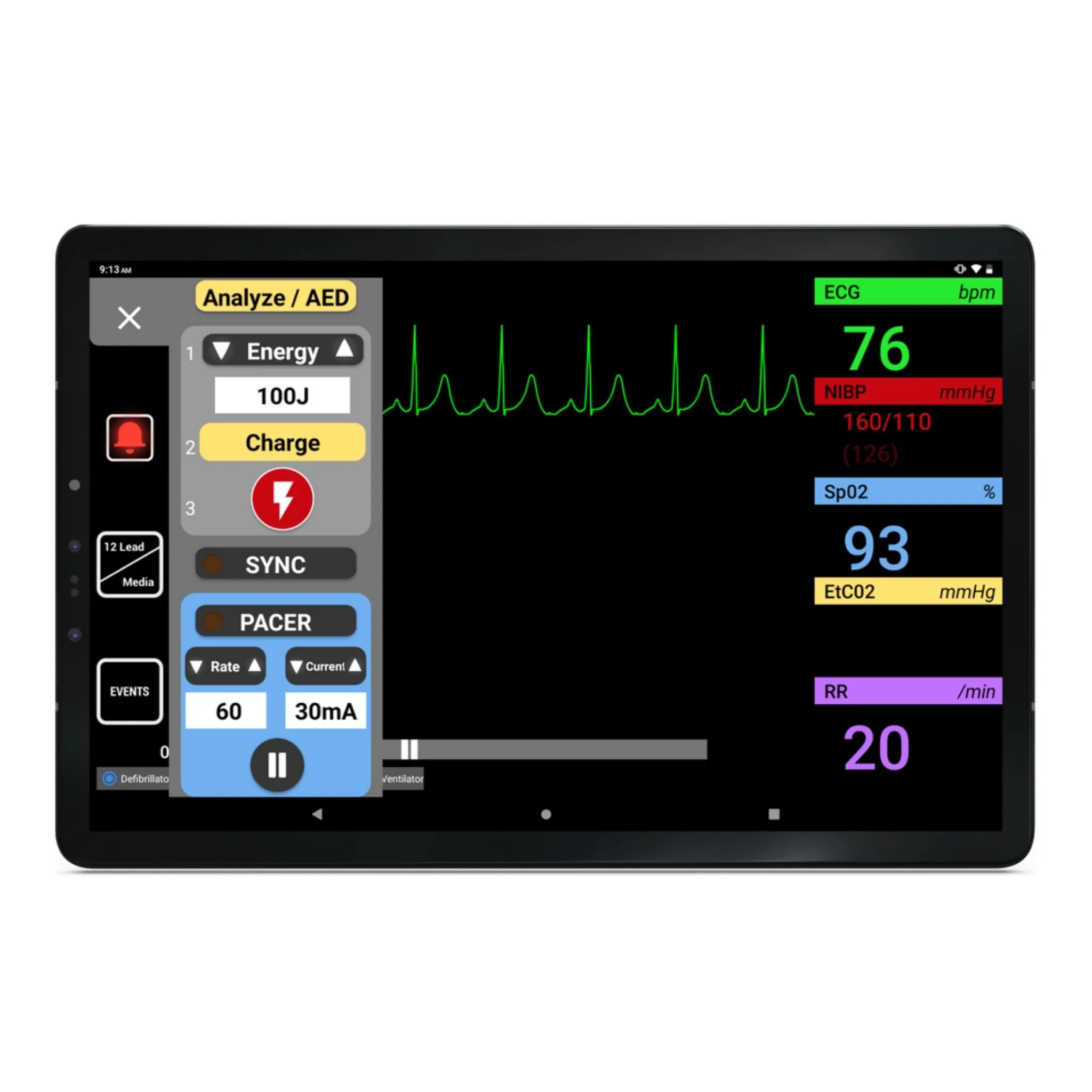 SimVS Simulated Patient Monitor Software