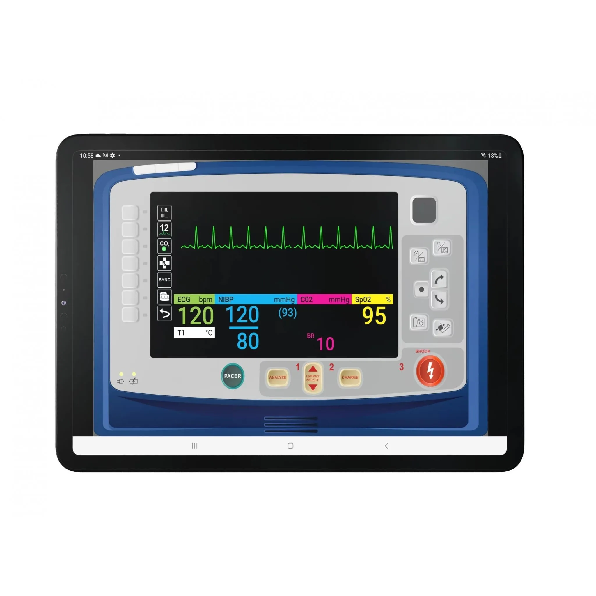 SimVS Simulated Patient Monitor Software
