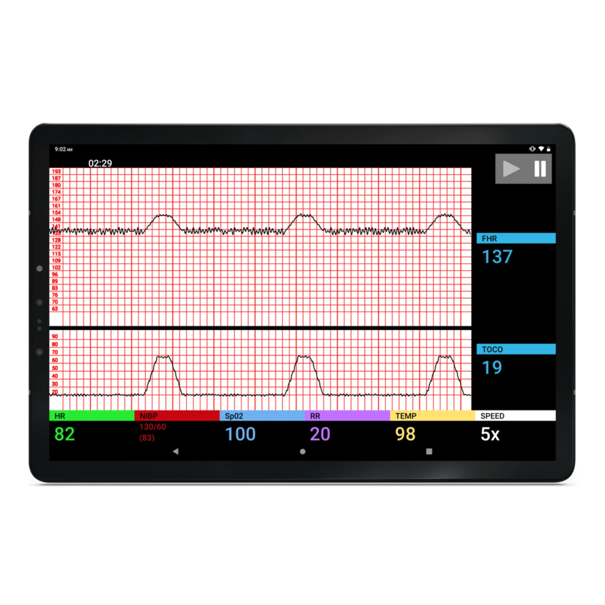 SimVS Simulated Patient Monitor Software